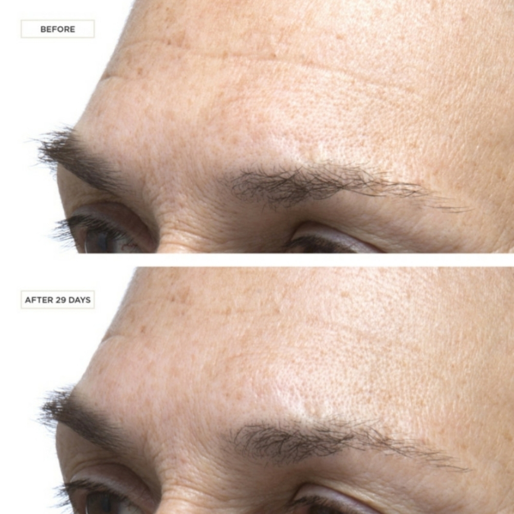 PERRICONE MD COLD PLASMA+ FACE ADVANCED CONCENTRAT - Picture 3 of 5